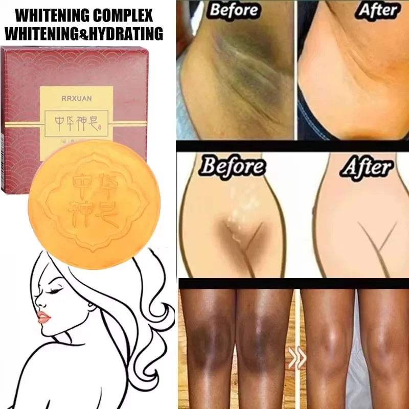 Jabón blanqueador corporal, limpieza profunda de la piel, jabón para eliminar la piel de gallina, axilas, rodillas, blanqueamiento corporal, productos para el cuidado de la piel blanca.