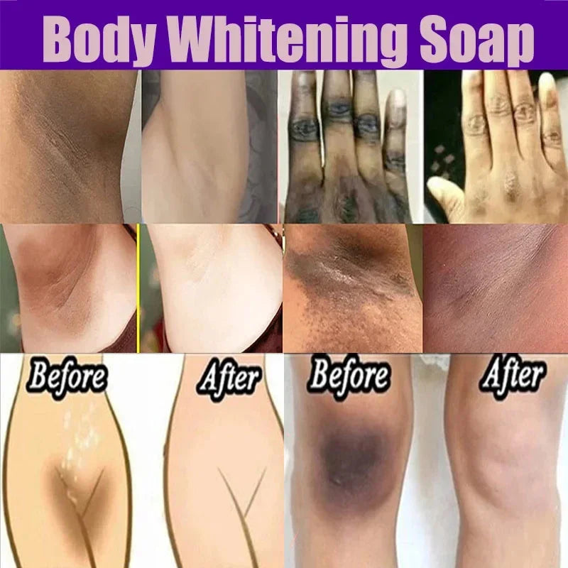 Jabón blanqueador corporal, limpieza profunda de la piel, jabón para eliminar la piel de gallina, axilas, rodillas, blanqueamiento corporal, productos para el cuidado de la piel blanca.