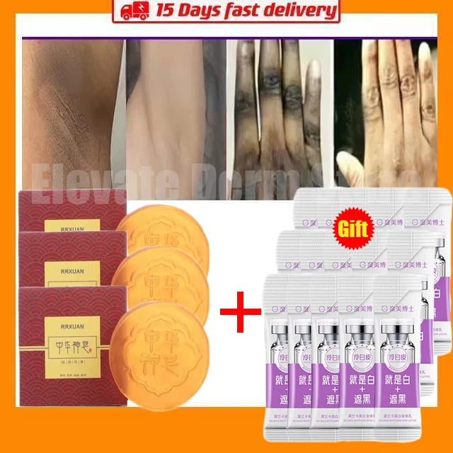 Jabón blanqueador corporal, limpieza profunda de la piel, jabón para eliminar la piel de gallina, axilas, rodillas, blanqueamiento corporal, productos para el cuidado de la piel blanca.