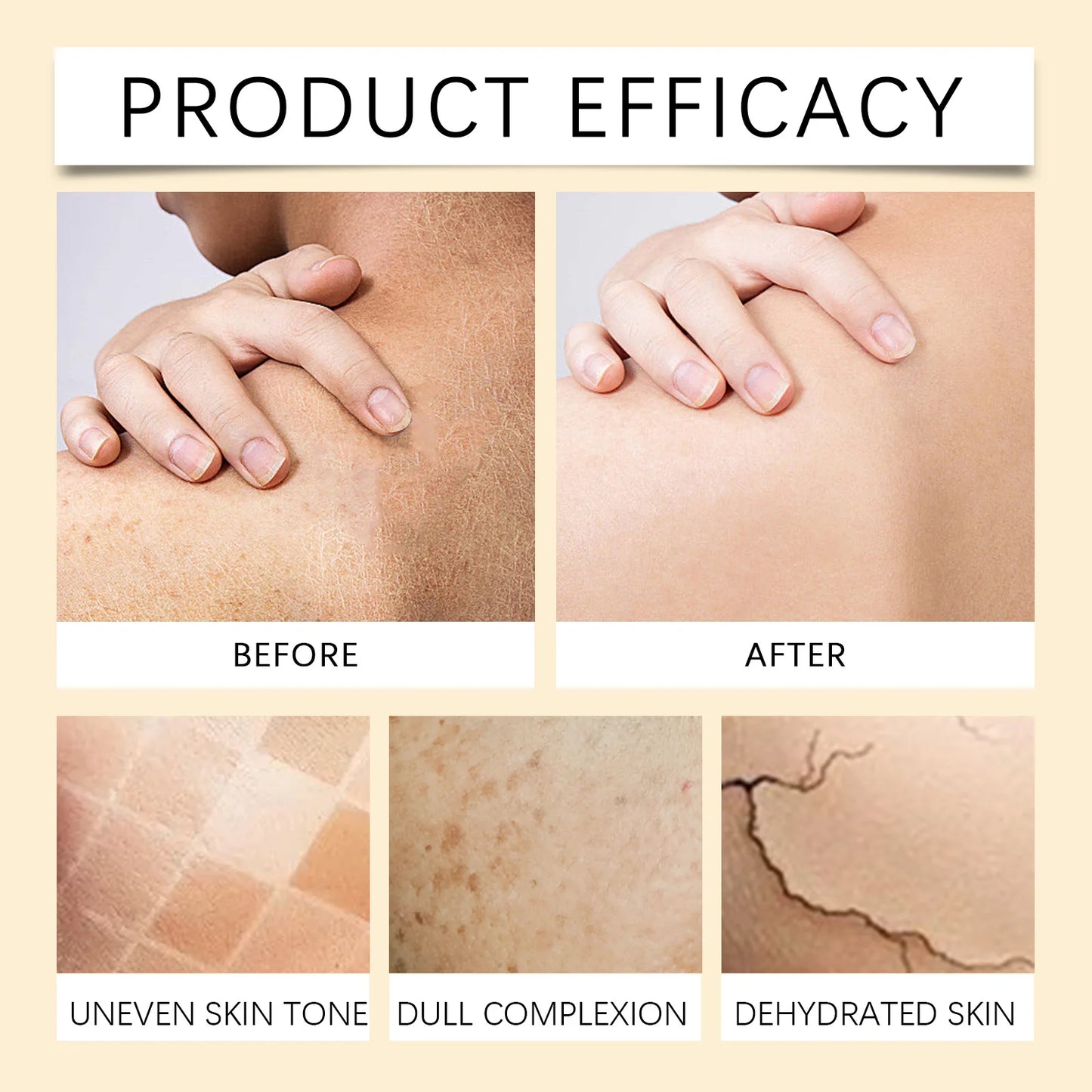 Exfoliante corporal de cúrcuma OUHOE, suero exfoliante suave de cúrcuma, hidratante, iluminador y suave, blanqueador y rejuvenecedor de la piel.