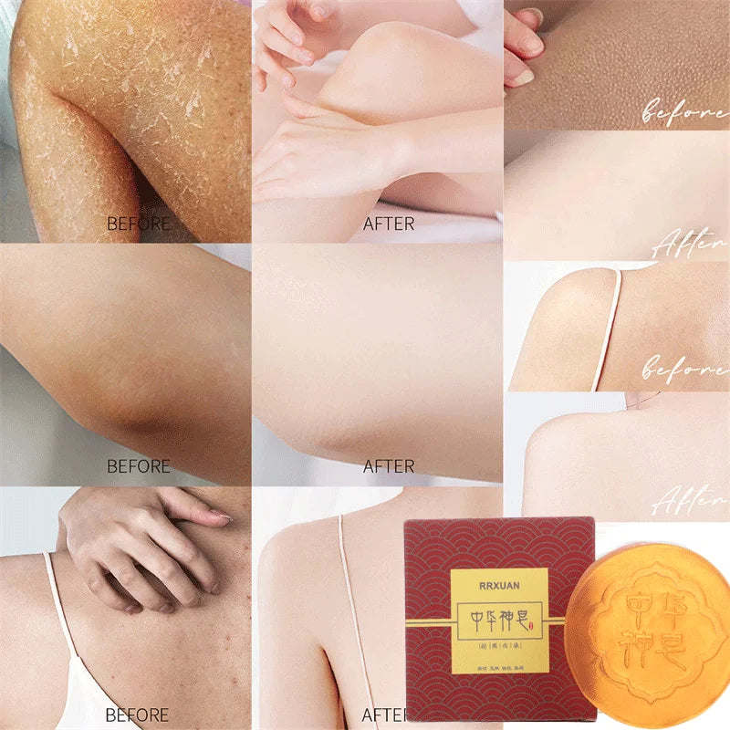 Jabón blanqueador corporal, limpieza profunda de la piel, jabón para eliminar la piel de gallina, axilas, rodillas, blanqueamiento corporal, productos para el cuidado de la piel blanca.