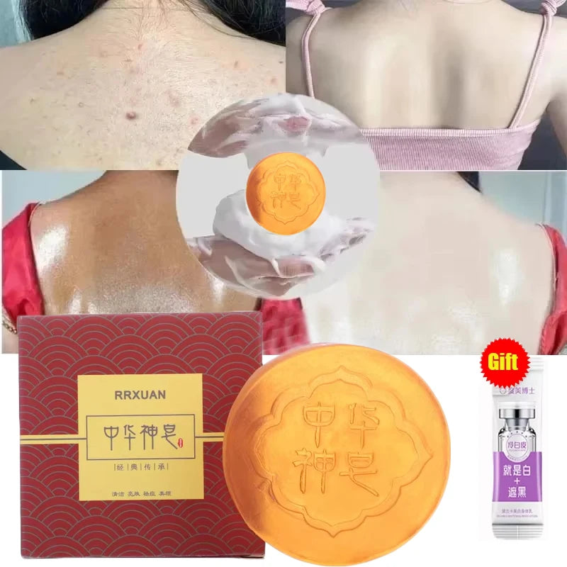 Jabón blanqueador corporal, limpieza profunda de la piel, jabón para eliminar la piel de gallina, axilas, rodillas, blanqueamiento corporal, productos para el cuidado de la piel blanca.