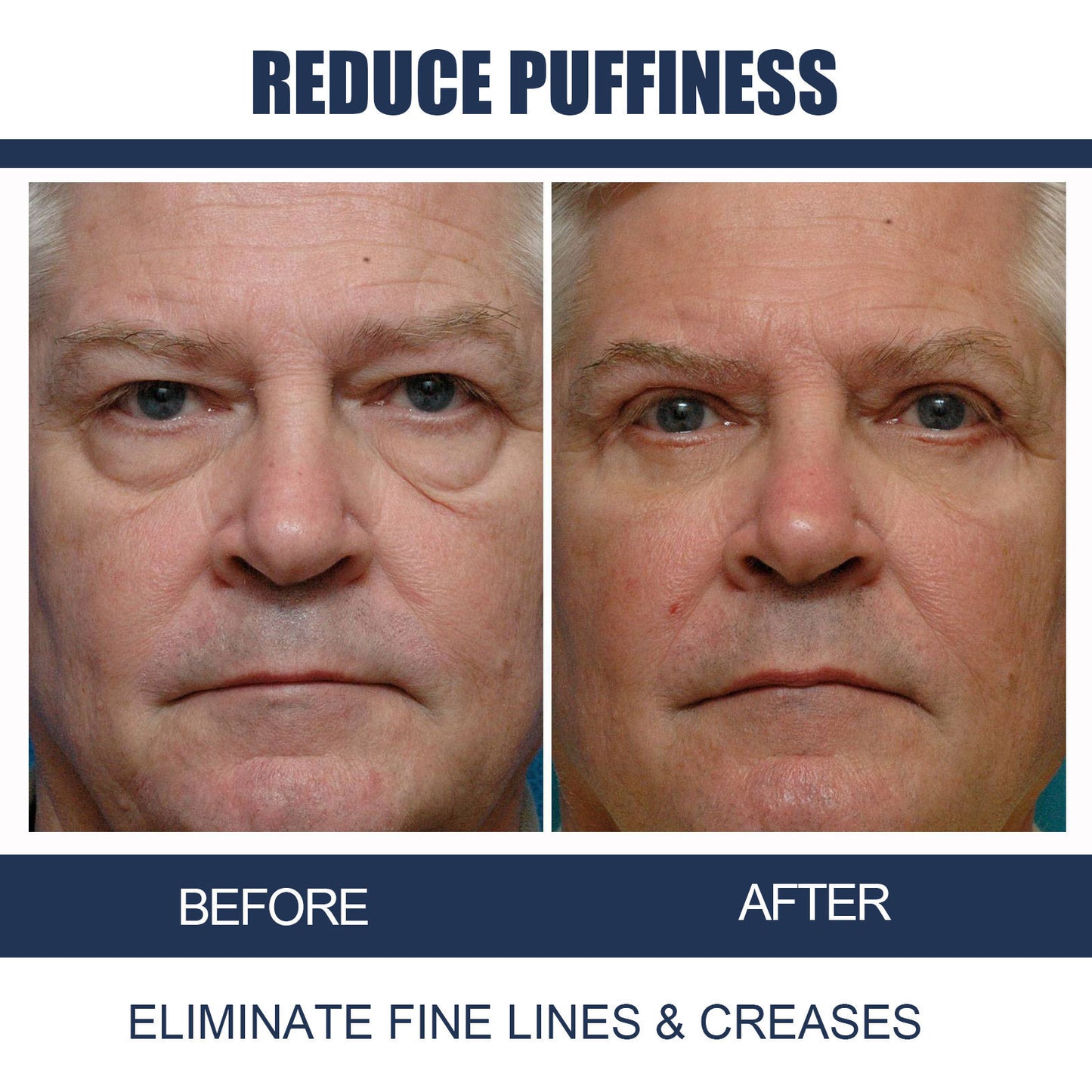 Crème contour des yeux hydratante et éclaircissante au rétinol pour hommes