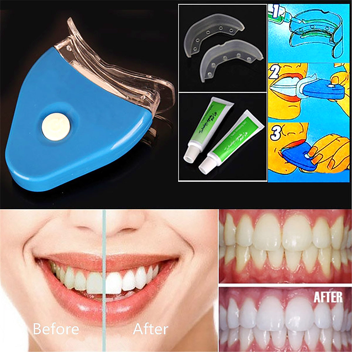 oral-gel-teeth-tooth-whitening-whitener-dental